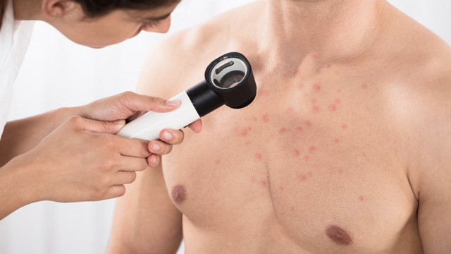 Görmezden gelmeyin hemen doktora koşun! Vücuttaki kırmızı lekeler alarm sebebi - Resim: 1