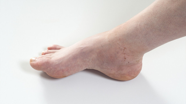 Görmezden gelmeyin hemen doktora koşun! Vücuttaki kırmızı lekeler alarm sebebi - Resim: 0