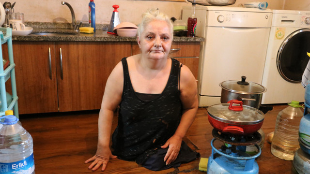 Ayakları olmayan engelli kadın isyan etti: Kollarımın da mı kesik olması lazım - Resim: 0