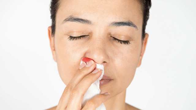 Bu hatayı yapmayan yok! Burnunuz kanayınca bunu yapın anında kurtulun - Resim: 0