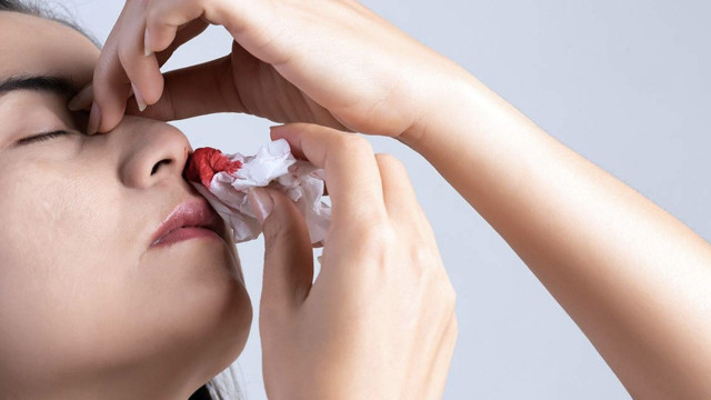 Bu hatayı yapmayan yok! Burnunuz kanayınca bunu yapın anında kurtulun - Resim: 2