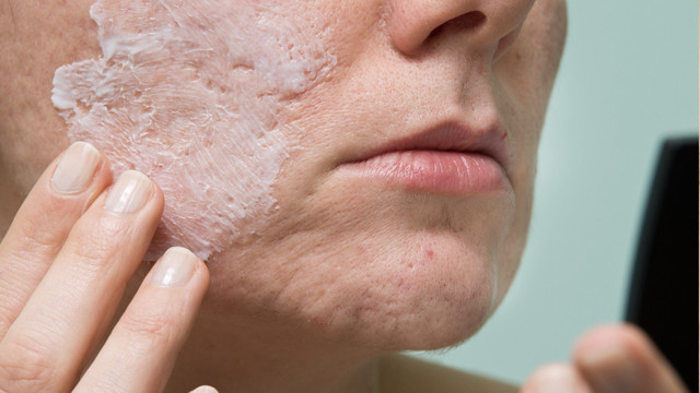 Bu aylarda cildim pul pul dökülüyor diyenler bunları yaşıyorsanız dikkat! - Resim: 0