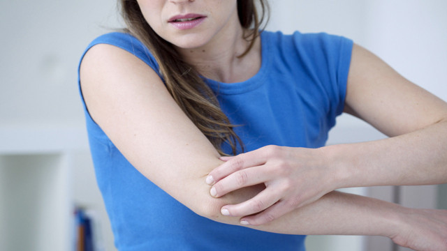 3 hafta sonra ortaya çıkıyor kaşıntıyla başlıyor! Aman dikkat kuduz olabilirsiniz - Resim: 1