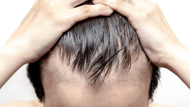 Sürün saçınız fışkırsın İşte saç dökülmesine meydan okuyan kür tarifi - Resim: 2