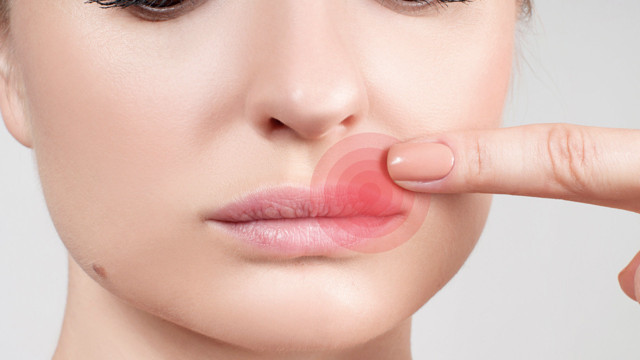 Dudağınızda çıkan uçuğu yok edecek doğal karışım! Günde 4 kez sürün sonucu görün - Resim: 1