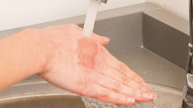 Diş macunu, et, yoğurt bunları unutun! İşte yanıklarda ilk yapılacak tedavi şekli - Resim: 2