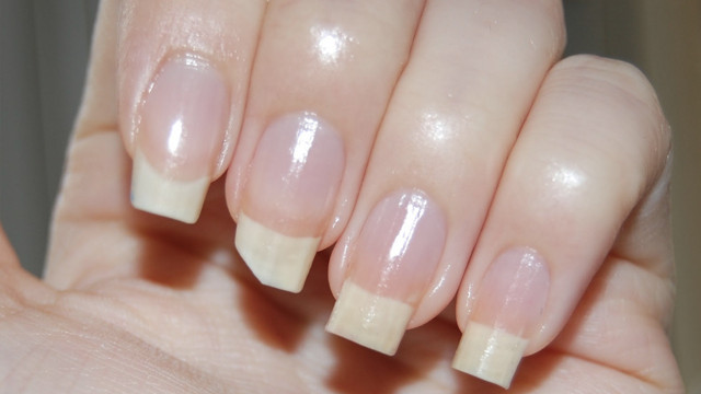 Tırnağınız sık sık kırılıyorsa ciddiye alın kansere bile yol açıyor! - Resim: 1