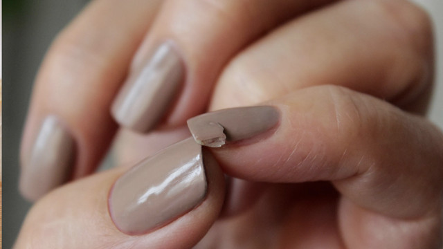 Tırnağınız sık sık kırılıyorsa ciddiye alın kansere bile yol açıyor! - Resim: 0