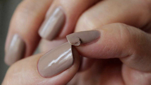 Tırnak bozulmasının nedenleri sakın hafife almayın! Ciddi hasta olabilirsiniz - Resim: 2