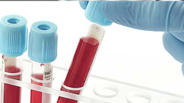 İşte kan grubuna göre diyet listesi kim nasıl diyet yapmalı? - Resim: 1