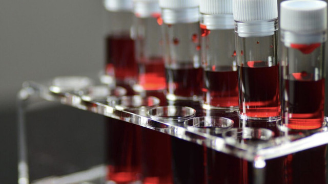 İşte kan grubuna göre diyet listesi kim nasıl diyet yapmalı? - Resim: 0