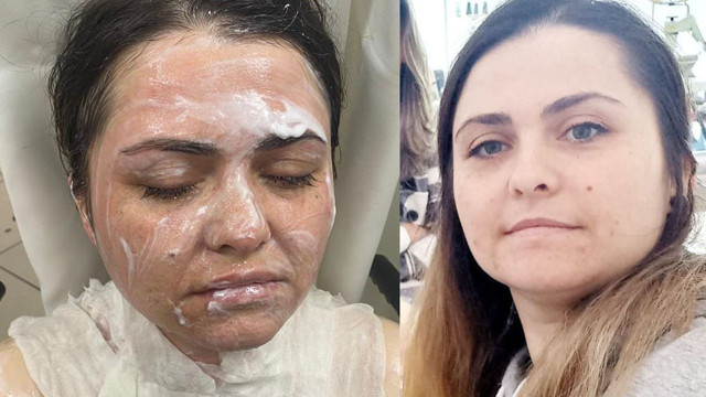 İstanbul'da eski koca dehşeti! Sokakta gizlenip kimyasal ile saldırdı: Güzelliğine mi güveniyorsun? - Resim: 0