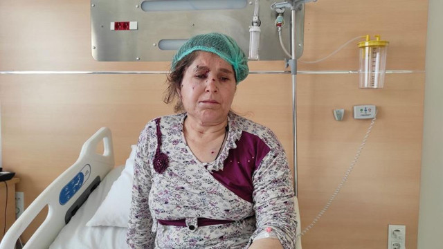 Eşinin evini tüfekle bastı, dehşet saçtı! Cani kocanın yaptıkları kan dondurdu: "Ayağına poşet eriterek..." - Resim: 2