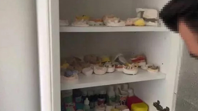 Kadın 40 bin liraya anlaştı, 'Dişçi' soyadlı sahte dişçi operasyona girince olanlar oldu - Resim: 0