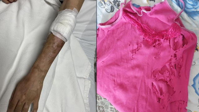 Masum gözüküyor cana mal olabilir! Evde bomba gibi patladı, genç kız: İnsanlar dikkatli olsun - Resim: 0