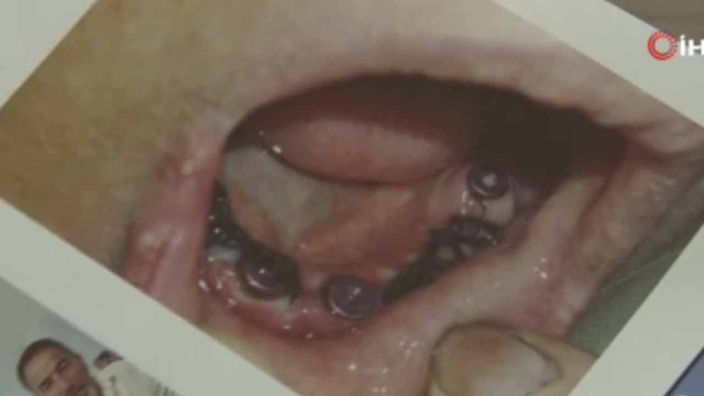 Daha güzel gülmek isteyen kadının yanlış tedavi nedeniyle hayatı karardı - Resim: 0