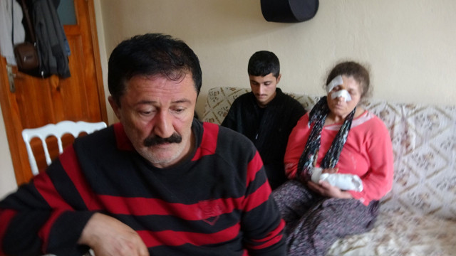 Bolu'da 4 çocuk annesi acımasızca darp edildi - Resim: 0