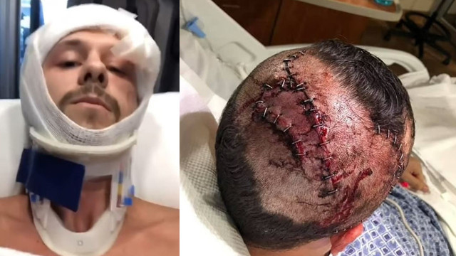 Ava giderken av oluyordu! Kafa derisinden ve elinden ısırıldı kanlar içinde kaldı - Resim: 1