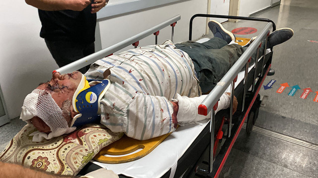 Tıra arkadan çarpan araç paramparça oldu: 1 ağır yaralı - Resim: 3