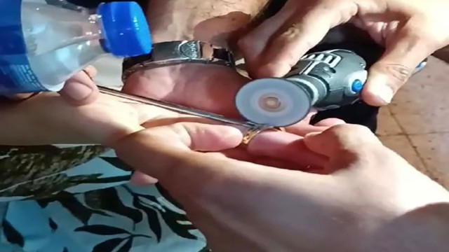 Hatay'da parmağına sıkışan yüzük hastanede çıkmayınca soluğu itfaiyede aldı! - Resim: 0