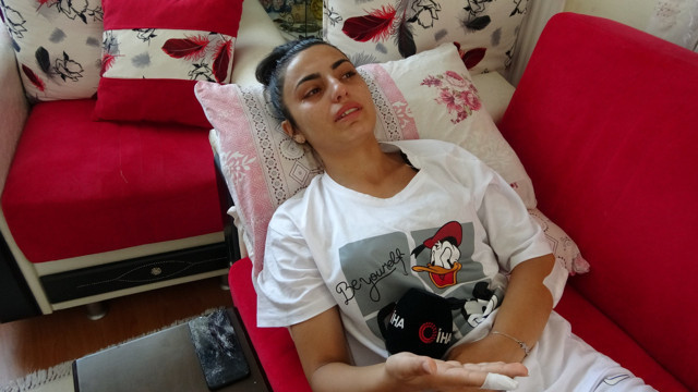 İşe giderken köpekler saldırdı! Ölümden dönen genç kadın o anları gözyaşlarıyla anlattı - Resim: 0