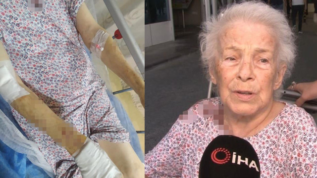 İstanbul'da başıboş maymun dehşeti: 3 kişiye saldırdı - Resim: 1