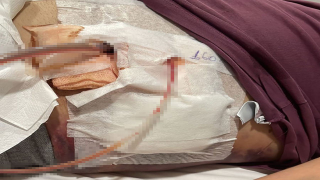 İnsanlık ölmedi deriten davranış! Arabayla kadını takip edip laf atan tacizcilere tepki gösterdi karnından bıçaklandı - Resim: 2