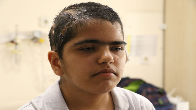 Antalya'da go-kart'ta çok feci olay! Saçı tekerleğe dolandı saç derisi kafasından ayrıldı - Resim: 0