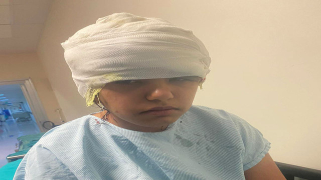 Antalya'da go-kart'ta çok feci olay! Saçı tekerleğe dolandı saç derisi kafasından ayrıldı - Resim: 4