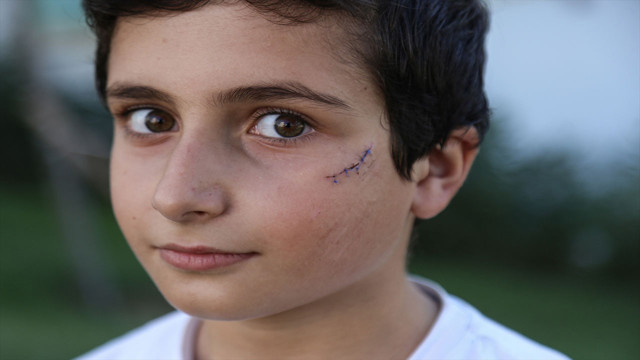 Silivri'de başıboş köpek dehşeti! Küçük çocuğu yüzünden yaraladı - Resim: 0