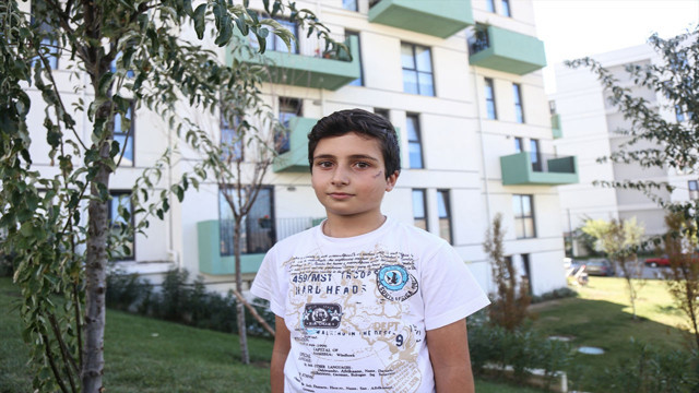 Silivri'de başıboş köpek dehşeti! Küçük çocuğu yüzünden yaraladı - Resim: 1