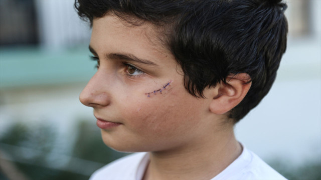 Silivri'de başıboş köpek dehşeti! Küçük çocuğu yüzünden yaraladı - Resim: 4