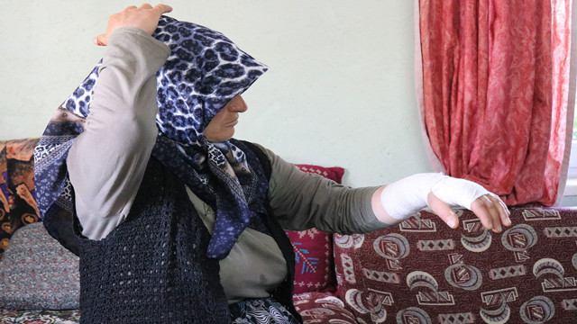 50 yaşındaki kadın arazisinde komşusu tarafından darp edildi! "Eline sopayı alıp vurmaya başladı" - Resim: 1