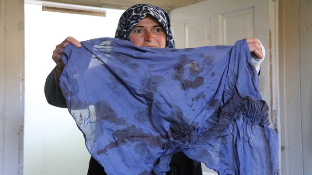 50 yaşındaki kadın arazisinde komşusu tarafından darp edildi! "Eline sopayı alıp vurmaya başladı" - Resim: 3