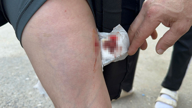 Sakarya'da sokak köpeği dehşeti! Küçük kızı bacağından yaralandı - Resim: 1