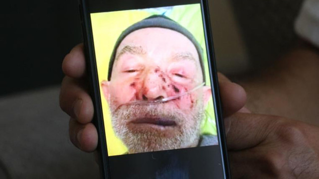 Sağlam bıraktığı babasını o halde görünce şoke oldu - Resim: 0