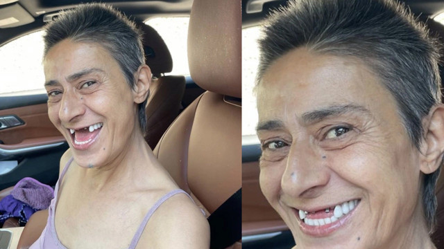 Yıldız Tilbe'den görenlere ne gerek vardı dedirten dişsiz paylaşım - Resim: 0