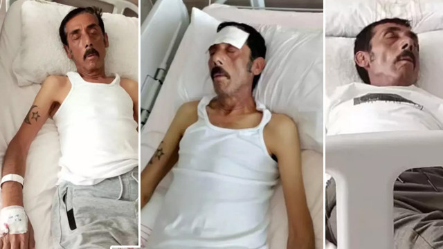 Ankaralı Turgut hastaneye kaldırıldı! Son hali görenleri üzdü - Resim: 0