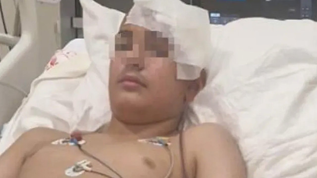 Konya’da kan donduran akran zorbalığı! Taşla vurdu, kafatasını kırdı, beyin zarı yırtıldı - Resim: 0