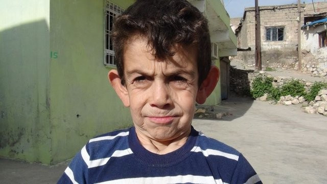 8 yaşındaki Mehmet'in yürek burkan dramı - Resim: 2