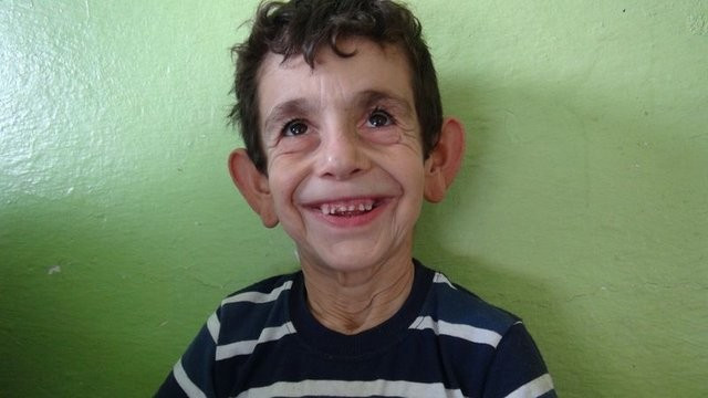 8 yaşındaki Mehmet'in yürek burkan dramı - Resim: 4