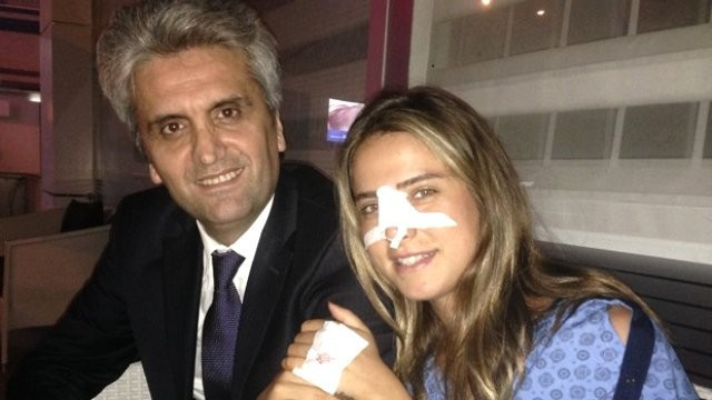 'Buyrun kırılan burnum' dedi Ceyda Ateş'ten olaylı yanıt! - Resim: 2