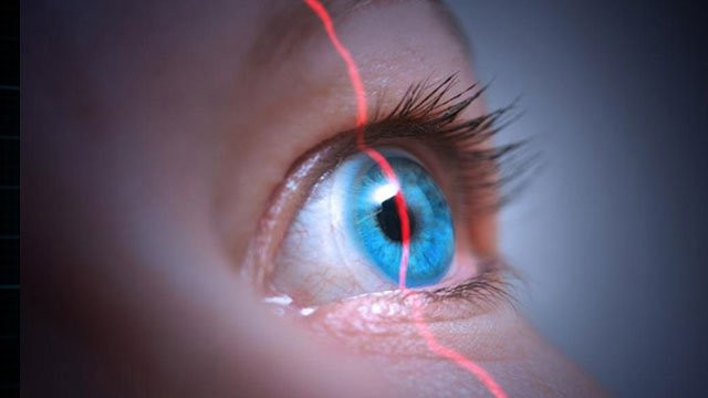 Göz doktoruna gidecekler dikkat! Yeni muayene yöntemine bakın - Resim: 3