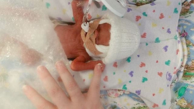 Prematüre bebekleri naylona sardılar bakın neden - Resim: 2