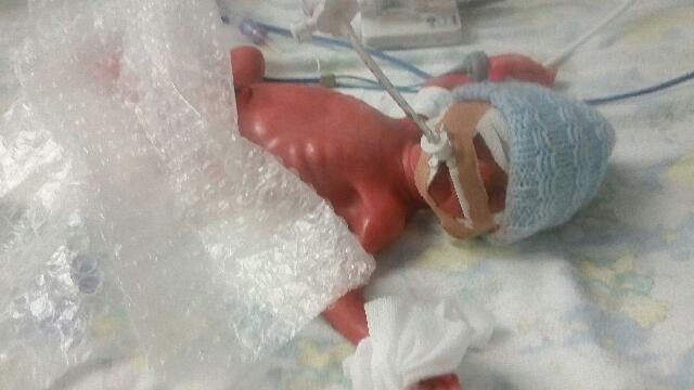 Prematüre bebekleri naylona sardılar bakın neden - Resim: 3