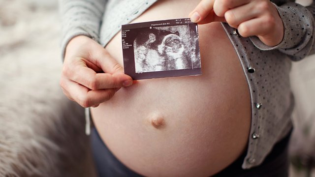 Türkiye'de bir ilk! Hamile kaldıktan bir ay sonra tekrar hamile kaldı! - Resim: 1