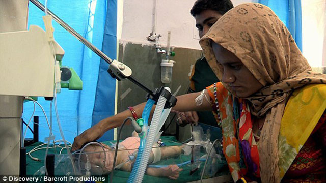 Milyonda bir rastlanan bebek - Resim: 4