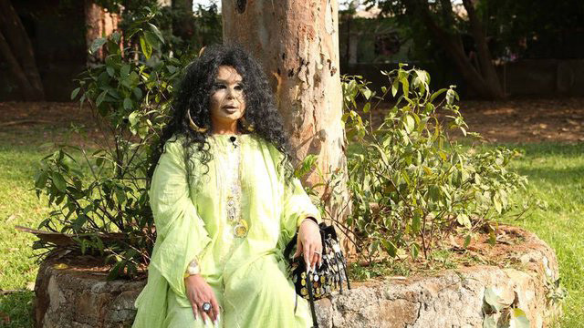 Ünlü şarkıcı köpek eti yedi hastanelik oldu - Resim: 3