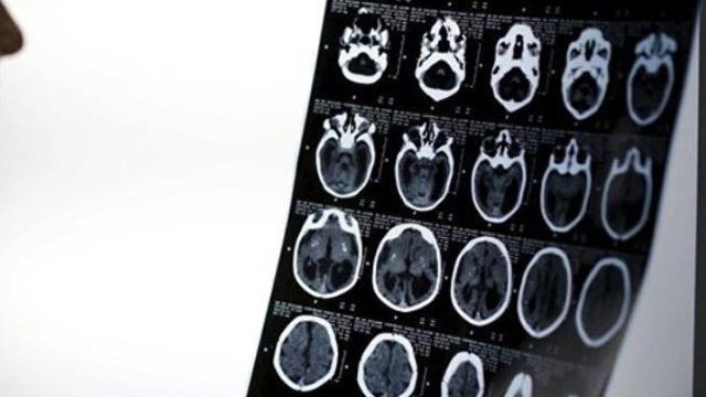 Polisler şoke oldu! Nefes almak için kafasına bıçak sapladı - Resim: 2