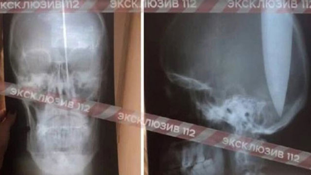 Polisler şoke oldu! Nefes almak için kafasına bıçak sapladı - Resim: 3